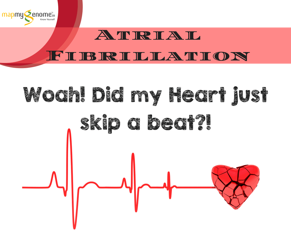 Atrial Fibrillation – Did My Heart Just Skip a Beat?!