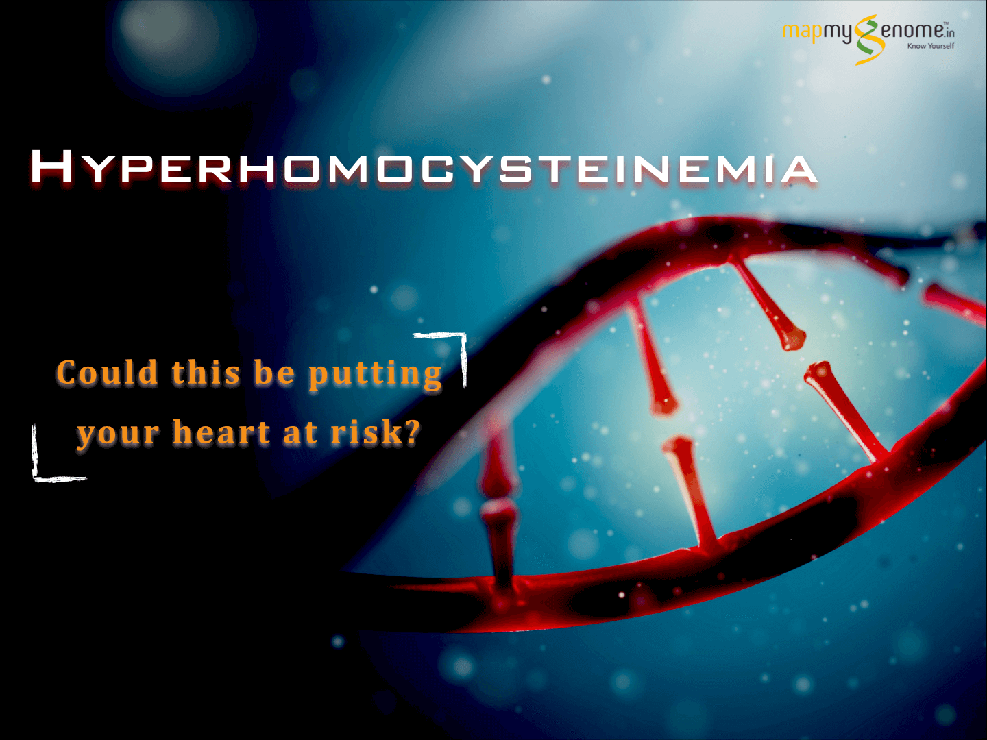 Hyperhomocysteinemia: Is It Putting Your Heart at Risk?