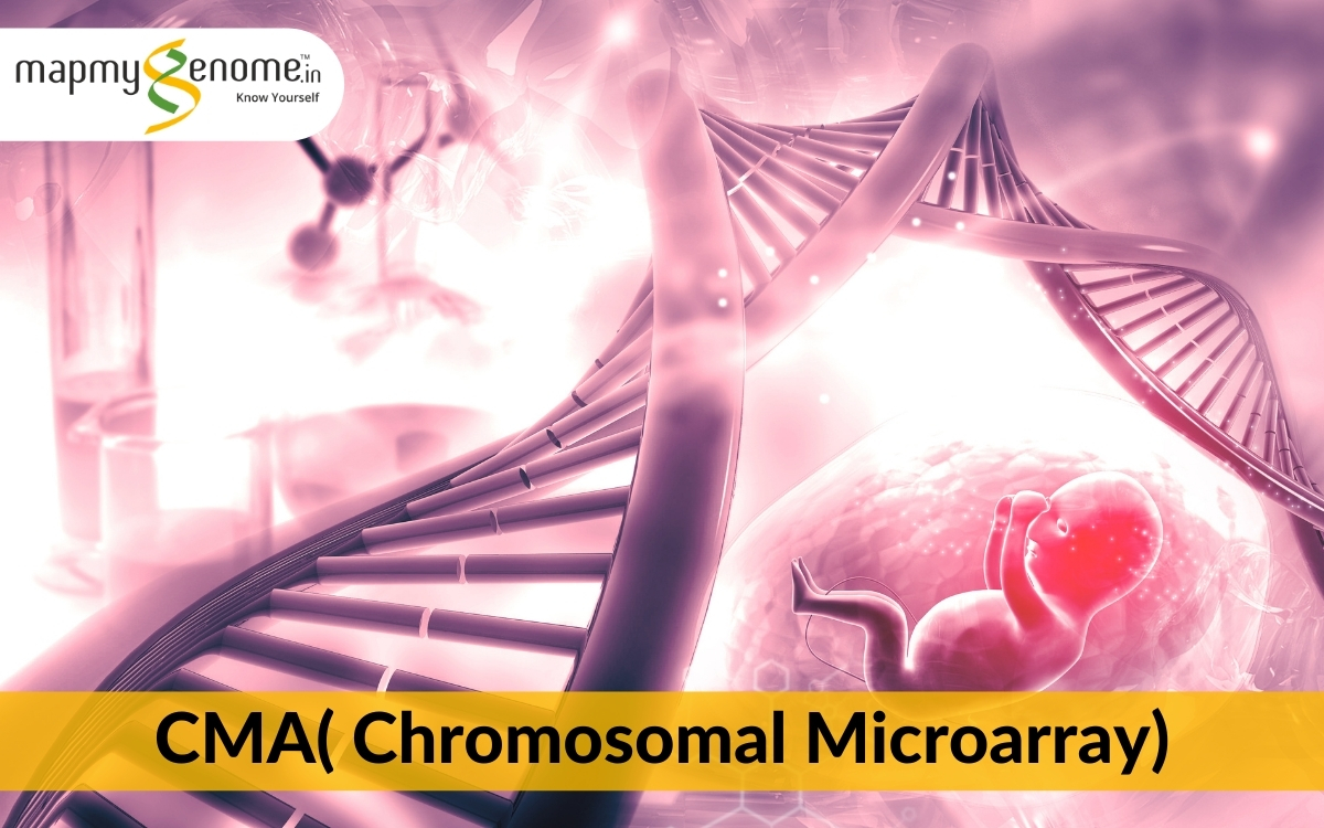 CMA( Chromosomal Microarray)- What, Who, Why, When and Where